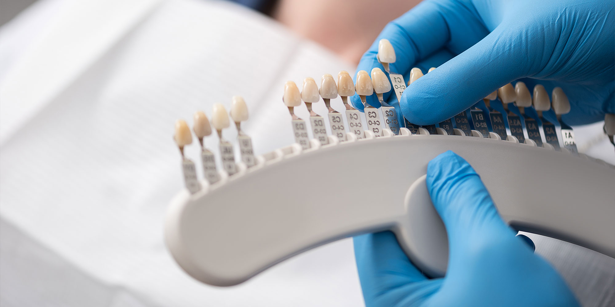 doctor showing dental veneers implants