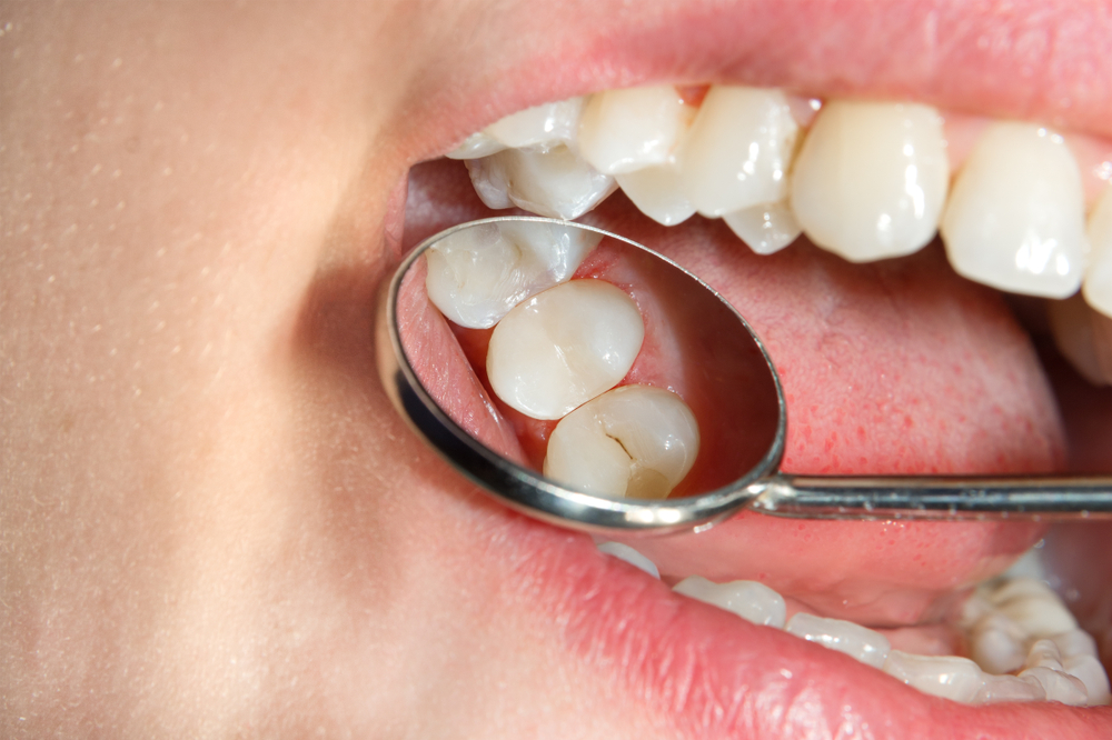 gum disease treatment