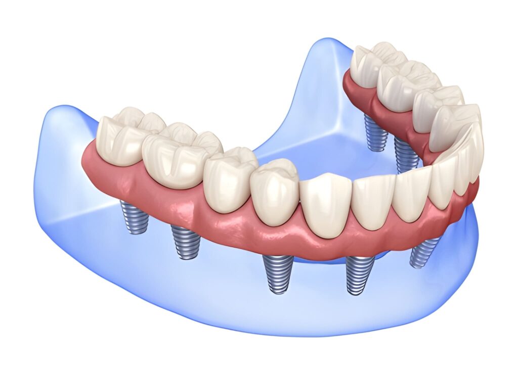 fixed teeth vs removable teeth near you
