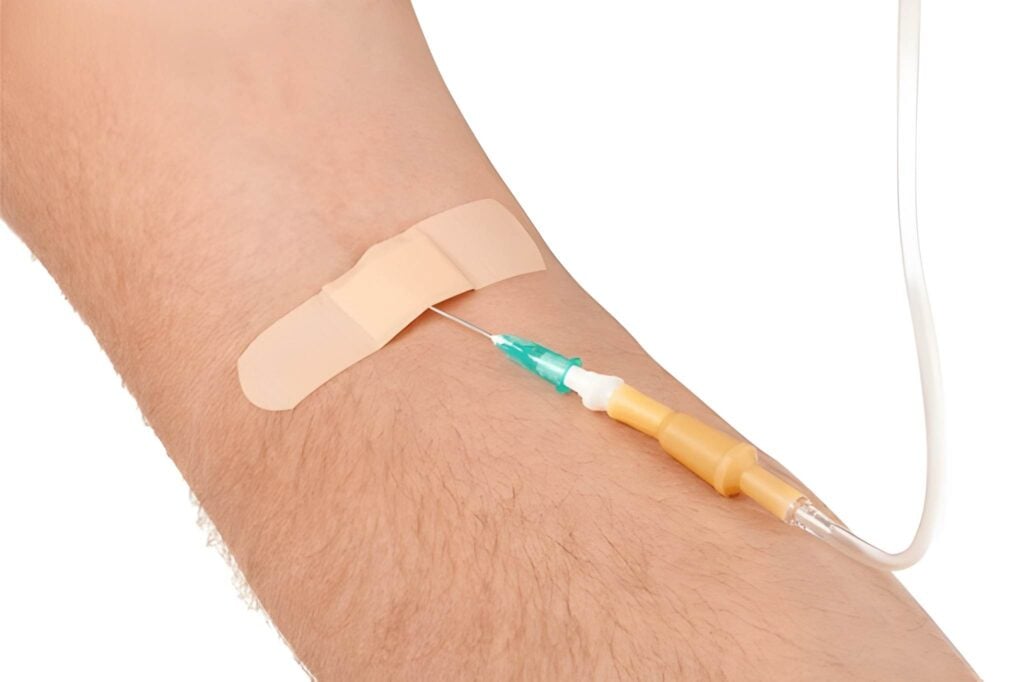 IV sedation needle and bandage on arm for comfortable dental procedures in Woodland Hills, California.